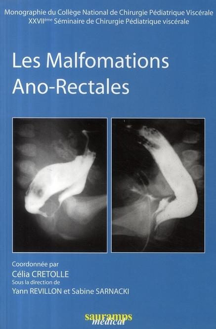 Foto Les malformations ano-rectales