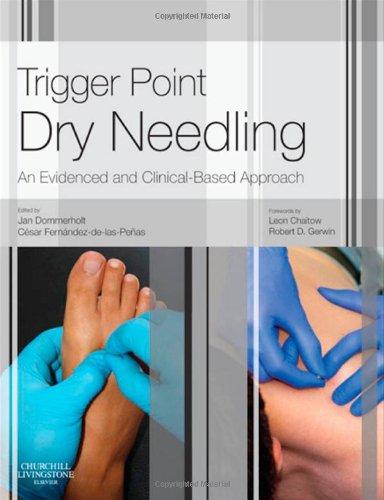 Foto Trigger Point Dry Needling: An Evidence and Clinical-Based Approach